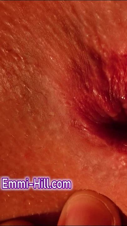 Skinny Girl Asshole Close Up Huge Labia Amateur Porn Feat Emmi Hill By Big 7 XHamster