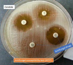 Antifungal Drugs Susceptibility Testing Introduction Mode Of Action Test