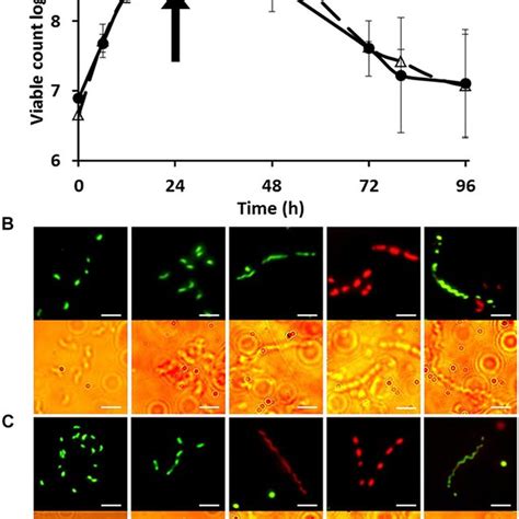 The Growth Curve Of And Morphological Changes Of Campylobacter Jejuni