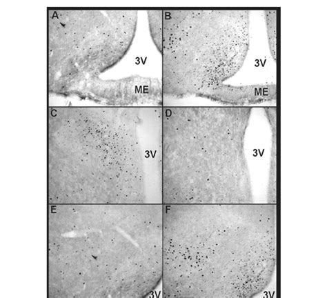 Representative Photomicrographs Of Fos Immunoreactive Cells In Coronal