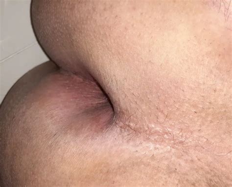 My Ass For You Cum 47 Pics XHamster