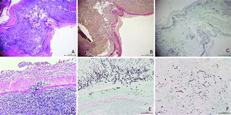 mages of the left internal carotid artery (ICA). A-C The wall of the... | Download Scientific ...