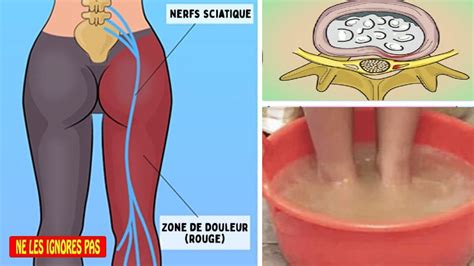 Comment Soulager La Douleur Du Nerf Sciatique En 10 Minutes YouTube