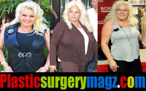 Beth Chapman Plastic Surgery Before and After Pictures | Plastic ...