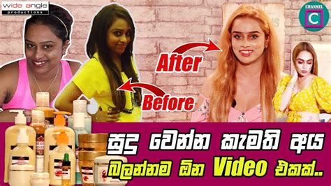 සද වනන කමත අය බලනනම ඕන එය සද වල තයන වදහ බලනනක