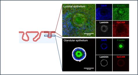 Research • The Mit Center For Gynepathology Research