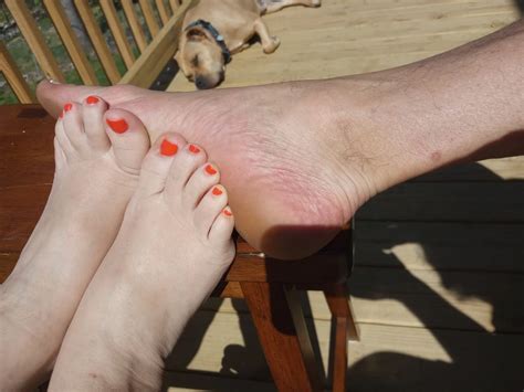 Footsie Nude Pics XHamster