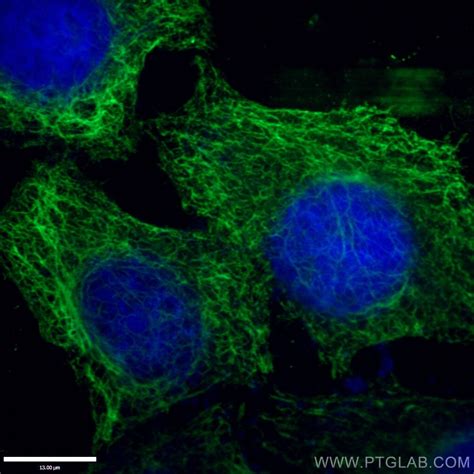 Vimentin Fusion Protein Ag0489 Proteintech