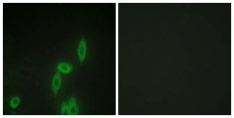 Anti Pcdh11y Protocadherin Y Antibody Rabbit Anti Human Lsbio