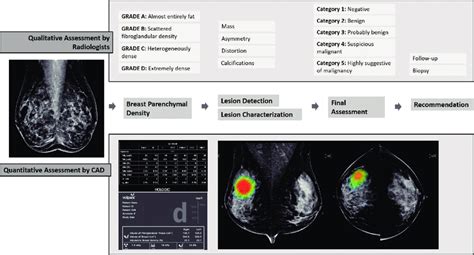 Workflow Of Mammography Interpretation With AI CAD Mammography