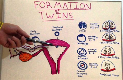 Formation Of Twins Embryology Video For Medical Students USMLE Step