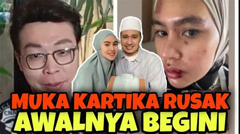 KONTROVERSI PENYAKIT KARTIKA PUTRI RICHARD LEE MENDO AKAN HABIB