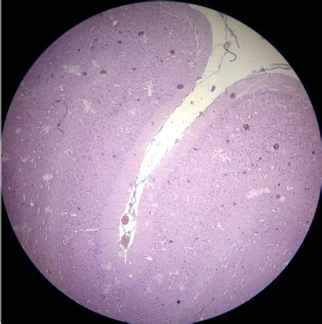 Fiszki Histologia Sem Quizlet