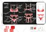 Fashion Design Flat Sketches For Lingerie Tech Pack By Fascin Fiverr