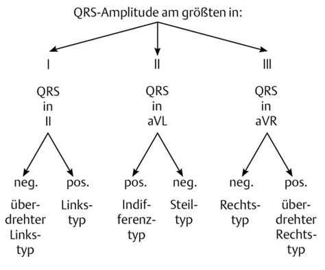 Ekg Diagnostik Karteikarten Quizlet