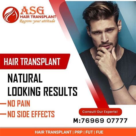 Get The Best Hair Transplant At ASG Hair Transplant Best Hair