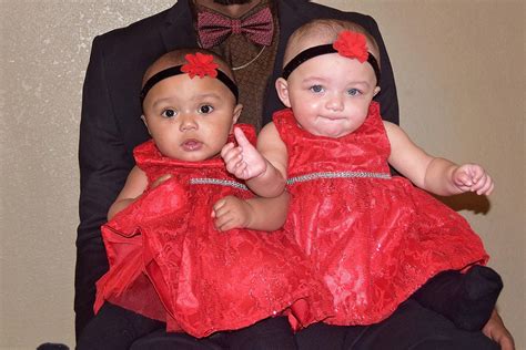 Mother Of Rare Biracial Twins Born In Illinois Speaks Out ‘we Dont