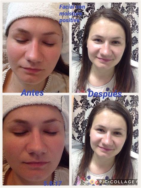 Antes Y Despu S De Un Facial Con Moisture Positive Mi Cliente Ten A La