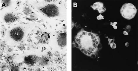 Syncytium formation by FIV. (A) Syncytia produced in CrFK cells adapted ...