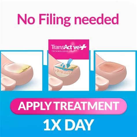 Excilor Ultra Color Nude Treats And Covers The Nail