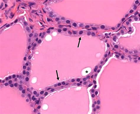 Thyroid gland – Veterinary Histology