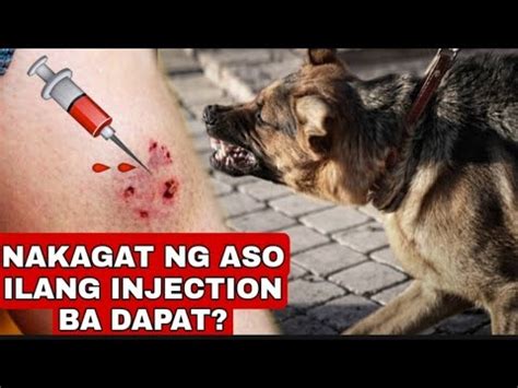 Nakagat Ng Aso Pusa Ilang Injection Ba At Saan Magpa Injection