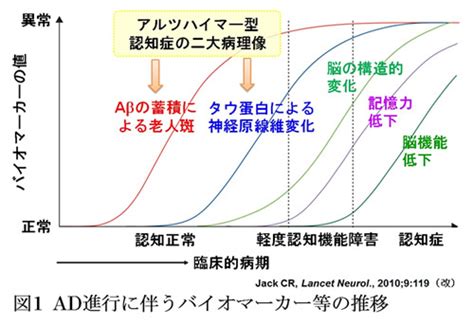 アミロイドイメージング（認知症） Pet研究について Himc 阪和インテリジェント医療センター