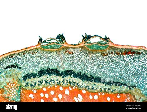 Typical Plant Stem Ts Showing Lenticels Brightfield Photomicrograph