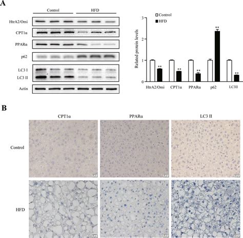 HtrA2 Omi Mitigates NAFLD In High Fat Fed Mice By Ameliorating