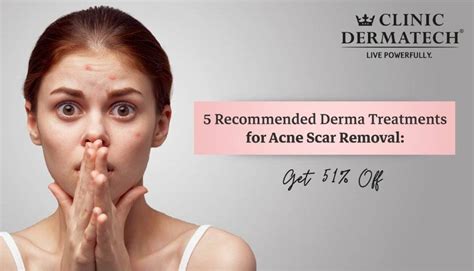 recommended derma treatments  acne scar removal