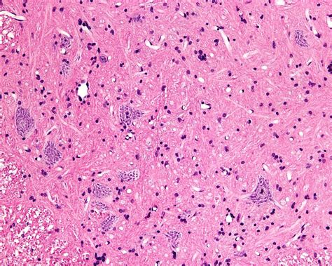 Nissl Substance Histological Constituents Of The Nervous System