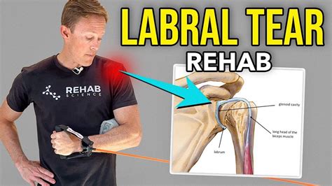 Shoulder Exercises To Heal And Recover From A Labral Tear Shoulder