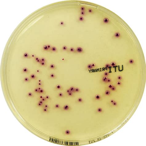 Primary Uti Chromogenic Agar E And O Laboratories Ltd