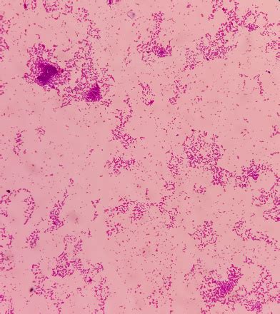 Microscopic View Of Enterococcus Bacteria From Uti Patient Urine Sample Show Grampositive Cocci ...