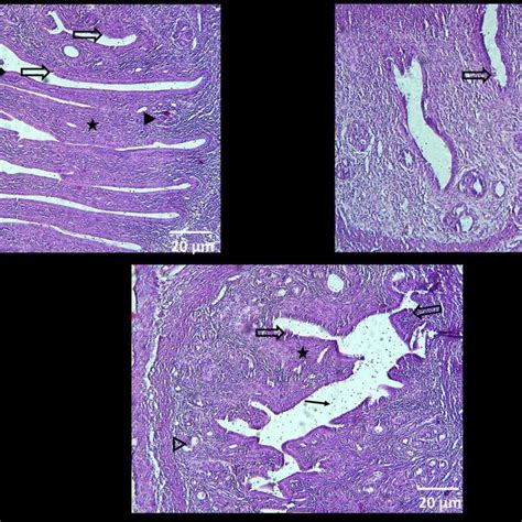 Representative Images Of The Histopathological Assessment Of Changes In