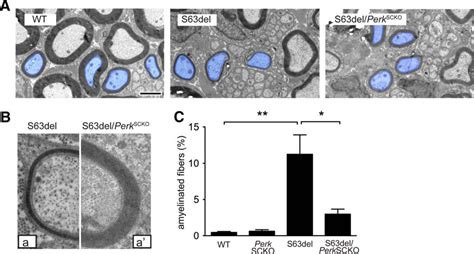 Ablation Of Perk In Schwann Cells Improves Myelination In The S63del