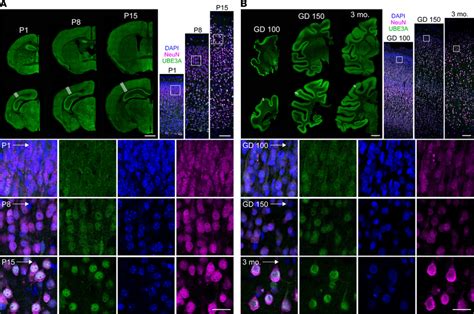 Conserved Regional And Subcellular Expression Of UBE3A In The