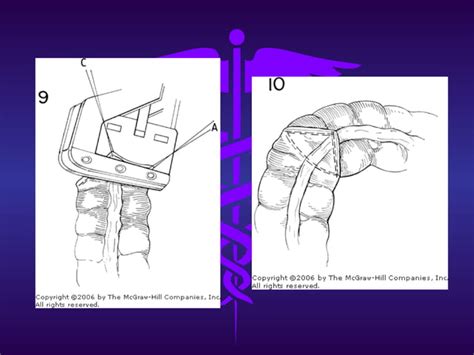 Anatom A Y Fisiolog A Del Colon Preparaci N Preoperatoria Ppt