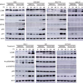 Tenovin Induces Apoptosis And Cell Cycle Arrest Of Gc Cells A