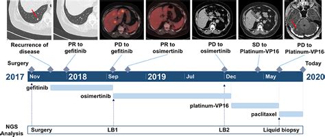 Frontiers Small Cell Lung Cancer Transformation As A Resistance