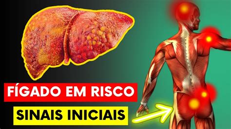 Fígado em Risco 11 Sintomas Incomuns que Você Não Pode Ignorar YouTube