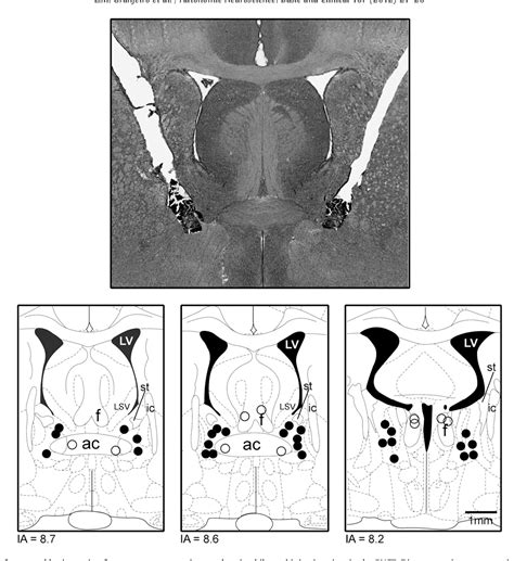 Figure 1 From Bed Nucleus Of The Stria Terminalis And The