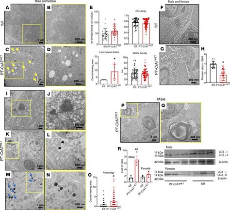 Jci Insight Intact Mitochondrial Substrate Efflux Is Essential For