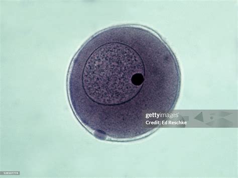 Starfish Embryology Fertilized Egg Fertilization Membrane And Polar ...