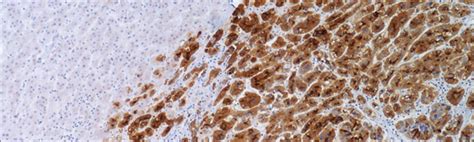 glypican   ml concentrate biolab