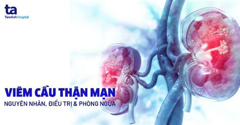 Tìm Hiểu Triệu Chứng đau Thận Trái Nguyên Nhân Cách Nhận Biết Và