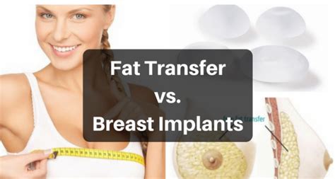 Fat Transfer Vs Breast Implants In Depth Guide You Must Know