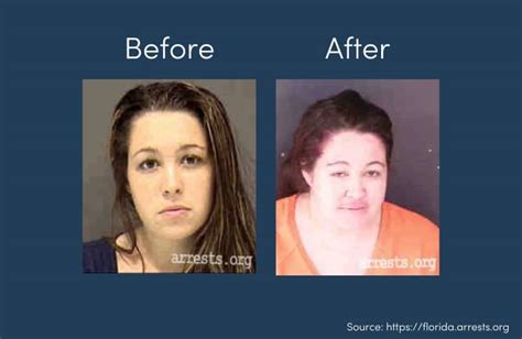 Coke Bloat Face Before And After