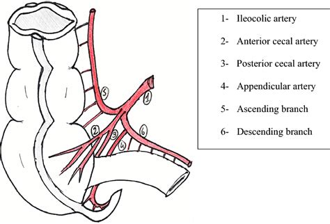 Ileocolic artery. 1. Ileocolic artery. 2. Anterior cecal artery. 3.... | Download Scientific Diagram