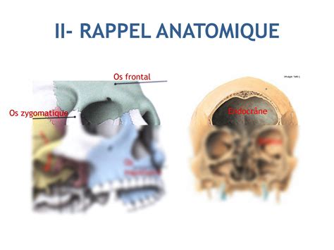 Solution Sarcomes Des Maxillaires Studypool